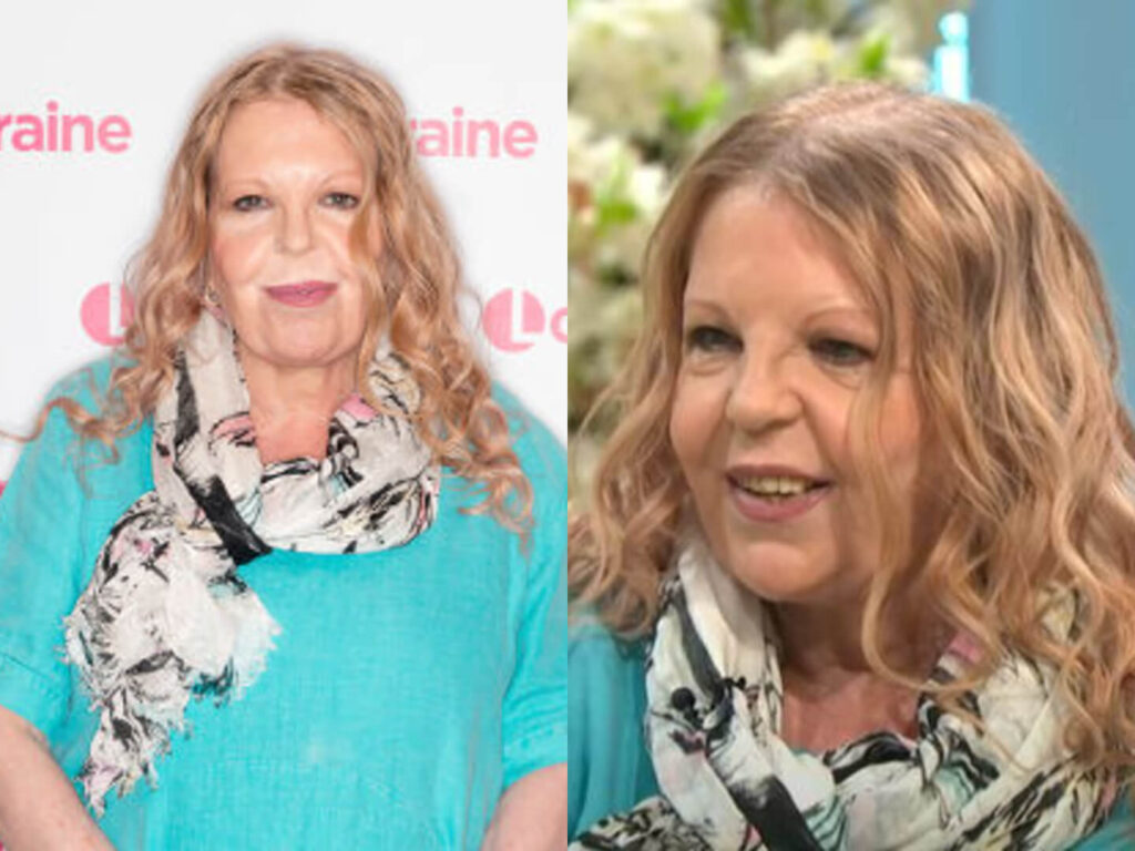 Sally Thomsett Illness: What Is Really Known About Her Health Sally Thomsett Illness